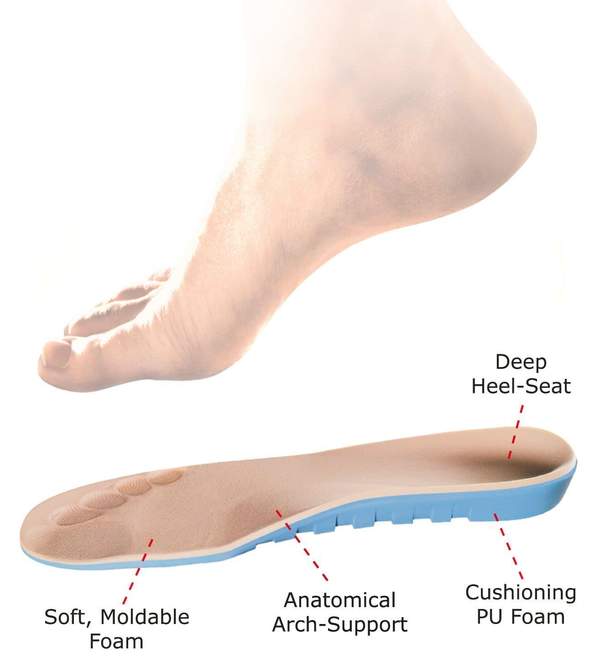 Best insoles for diabetes and neuropathy Orthofeet