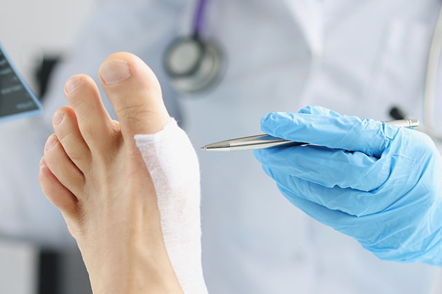 Doctor performing a Pin Prick Test on a diabetic foot